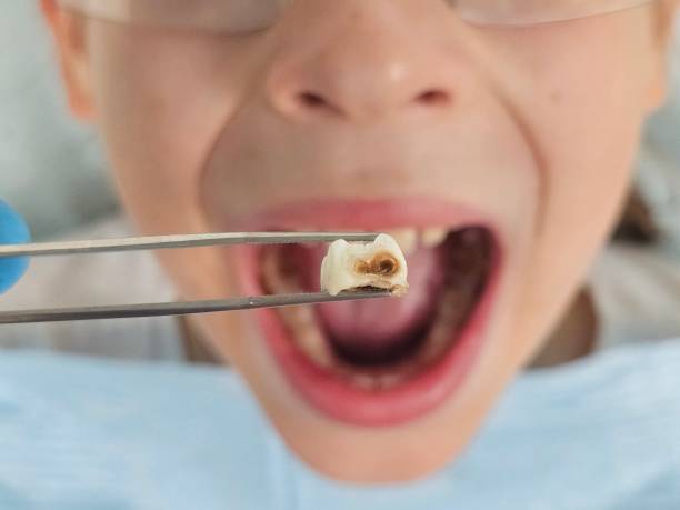 Best Emergency Gum Treatment in Myersville, MD