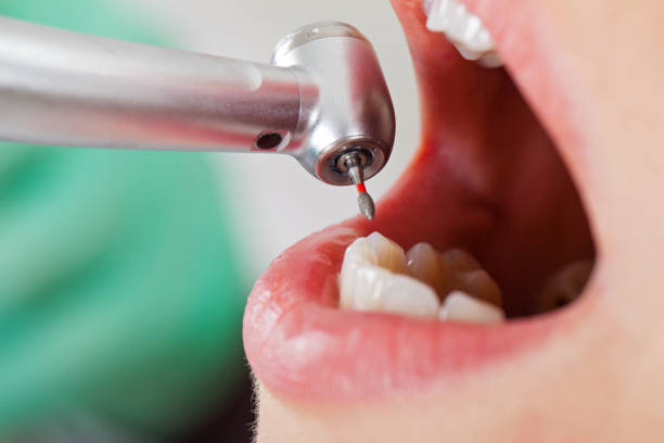 Best Emergency Dental Care for Broken or Chipped Teeth in Myersville, MD